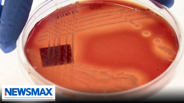 CDC: Deadly fungus spreading at an alarming rate | Wake Up America