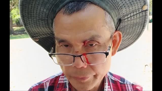 Assault Leaves Falun Gong Practitioner Bloodied, Days After Bomb Threat