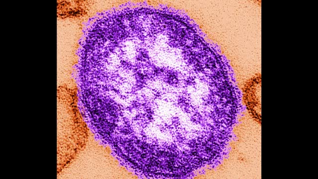 More Than 250 People Quarantined in South Carolina Over Measles Outbreak, Officials Say