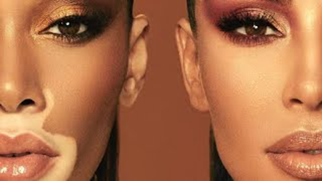 Do We Need to Decolonize Beauty Standards?